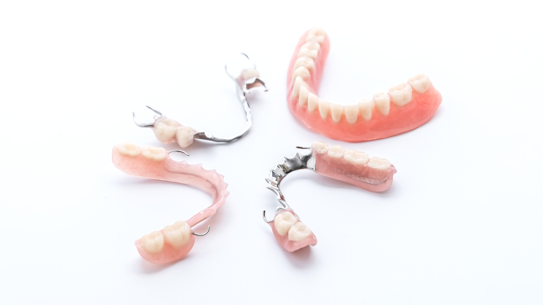 parcijalna proteza za zube
