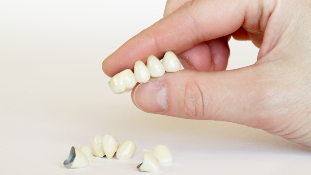 krunice za zube, corone dentali