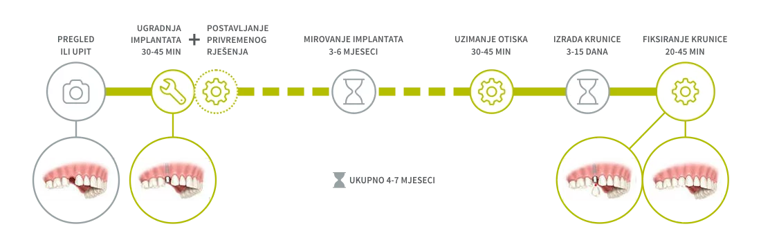 Implantologija - Nedostatak jednog zuba