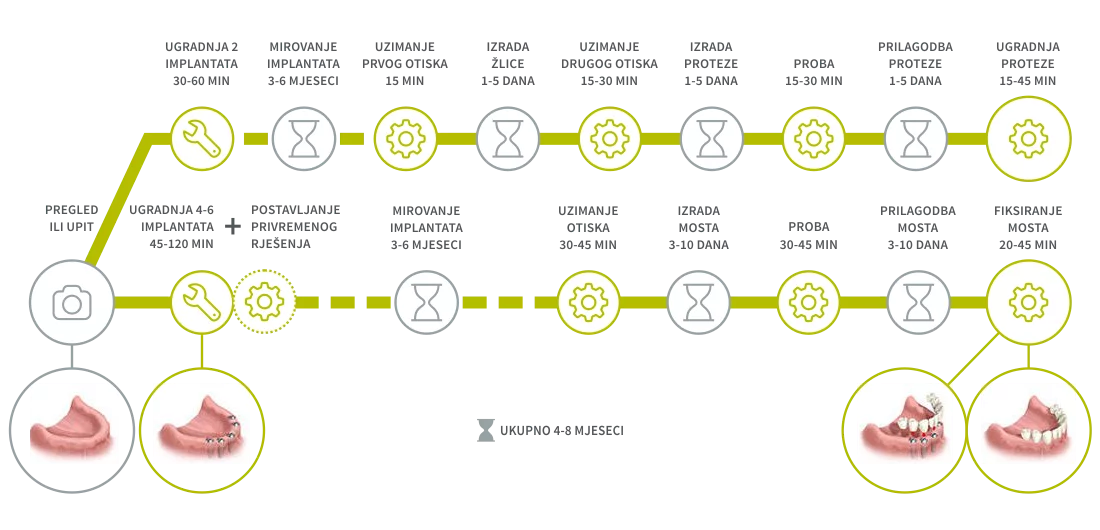 Implantologija - Nedostatak svih zubi
