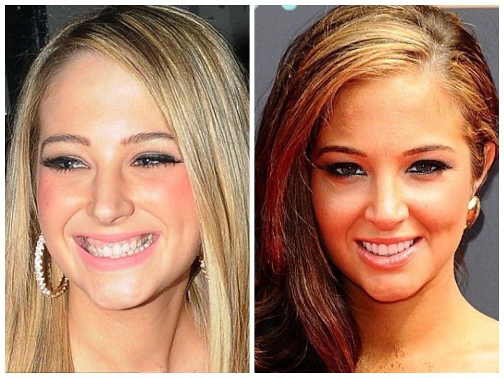 Tulisa-ljuskice