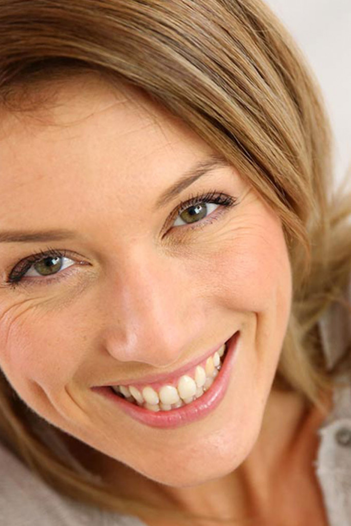 Wrinkle smoothing with hyaluronic fillers