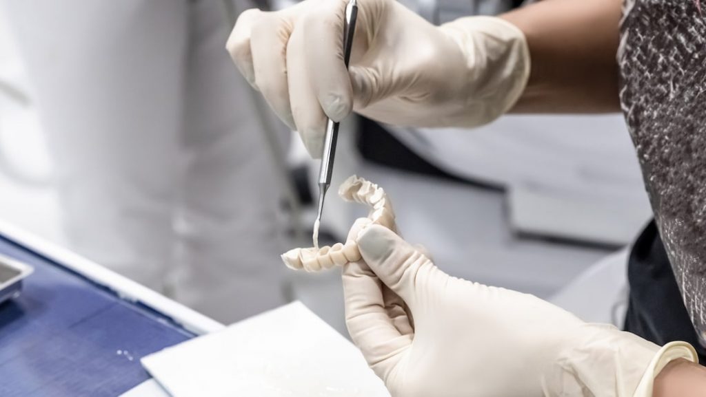 Lavori temporanei per terapie odontoiatriche a lungo termine