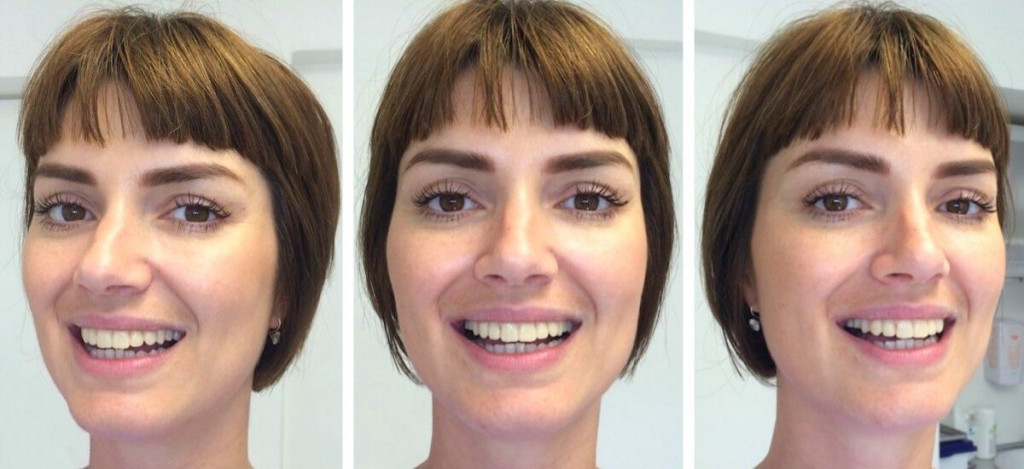 Smile design Smile Studio