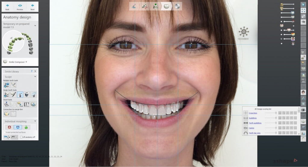 Smile Design