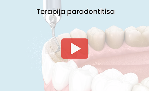 Paradontolog u Rijeci