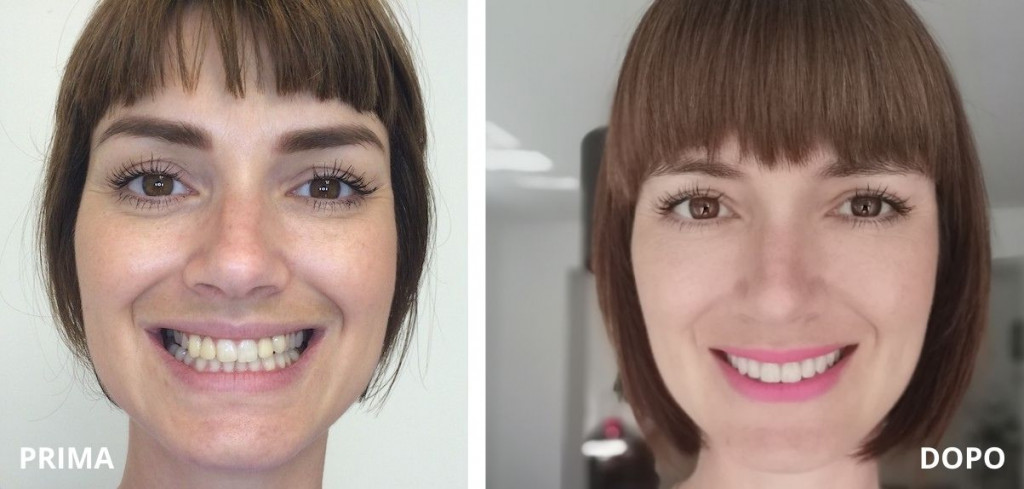 Smile design Smile Studio