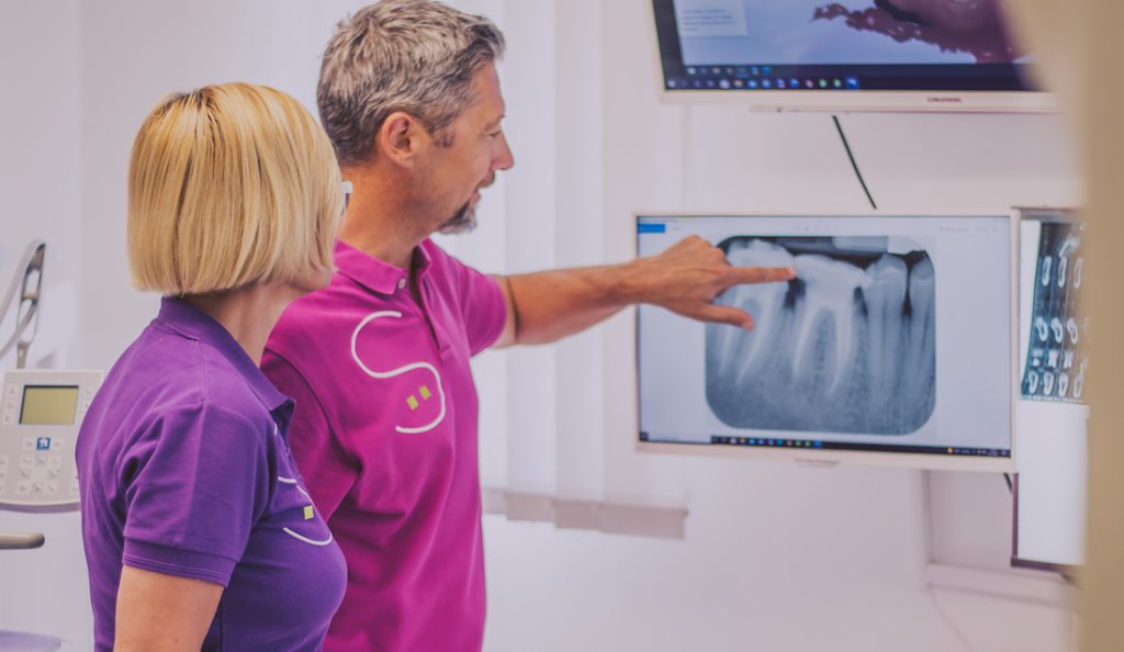 Idee sbagliate sugli impianti dentali